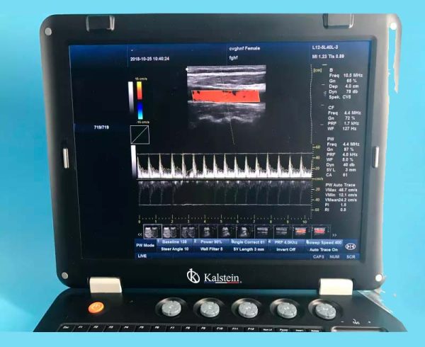 Máquina de ultrasonido THI médica 3D de 128 elementos a la venta con sonda convexa YR05148 - Imagen 2